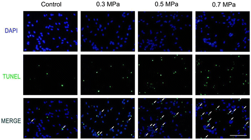 Fig. 6. TUNEL detection show different scale of cell apoptosis in different mechanical compression groups.Notes: Compared with the control group (A–C), the mechanical insulted groups of 0.3 MPa (D–F), 0.5 MPa (G–I) and 0.7 MPa (J–L) presented obvious increased TUNEL positive cells which indicated apoptosis cells. The white arrows show the TUNEL positive cells. Scale bar, 50 μm.