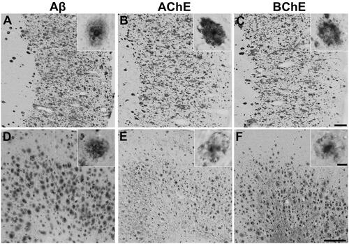 Figure 1. Representative photomicrographs showing staining of plaque pathology for Aβ immunohistochemistry (A, D) and AChE (B, E) and BChE (C, F) histochemistry at pH 6.8 in the cerebral cortex of human AD (A-C) and 5XFAD mouse (D-F) brain tissues. Insets are higher magnification photomicrographs showing examples of plaque pathology. Note the similarities in the cortical plaques stained for Aβ, AChE, and BChE. Scale bars = 200 µm, insets = 10 µm.