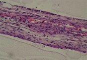 Figure 19 Regenerated nerve fibers grow through the conduit (4th week, HE staining, 40x).