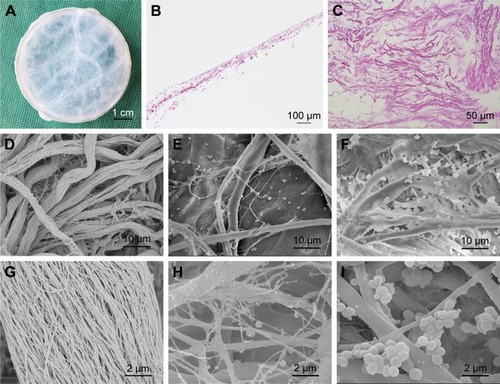 Figure 1 Structural properties of the scaffolds.Notes: (A) Macroscopic view of SIS membrane after decellularization treatment. (B) H&E staining image of SIS sectioned at longitudinal direction. (C) H&E staining image of SIS sectioned at horizontal direction. (D–I) SEM images of SIS incubated in SBF solution for 0 days (D and G), 7 days (E and H), and 14 days (F and I) at two magnifications.Abbreviations: SBF, simulated body fluid; SEM, scanning electron microscopy; SIS, small intestinal submucosa.