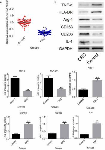 Figure 1. The lncRNA NBR2 was downregulated and M2 polarization was abundant in CRC patients. A) The expression of the lncRNA NBR2 in the tissues was evaluated by qRT-PCR. B) The expression level of TNF-α, HLA-DR, Arg-1, CD163, CD206, and IL-4 in the tissues was determined by western blot (**P < 0.01, vs. Control)