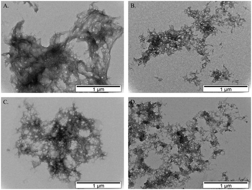 Figure 3. TEM images of Aβ self-aggregation inhibition experiments of compound 1: (a) absence of compound 1 and absence of copper; (b) presence of compound 1 and absence of copper; (c) absence of compound 1 and presence of copper; (d) presence of compound 1 and presence of copper.