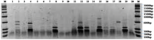 Figure 2a. ARDRA of 20 bacterial isolates with double restriction endonuclease AfaI + MspI.