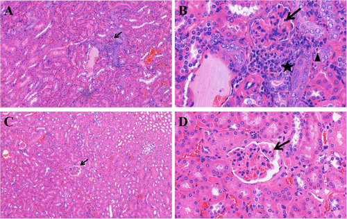 Figure 1 Representative H&E staining for renal histopathology. In the control group, panel (A) (H&E stain, 100×) and panel (B) (H&E stain, 400×), glomerulosclerosis, atrophy, partial vascular occlusion (arrow), obvious infiltration of lymphocytes between glomeruli and tubules (pentagram), fragmentation of a necrotic nucleus (triangle) and proliferation of the basement membrane were observed. In the experimental group (17-AAG treated group), panel (C) (H&E stain, 100×) and panel (D) (H&E stain, 400×), the degree of glomerular inflammatory infiltration (arrow) was lower than that in the control groups.
