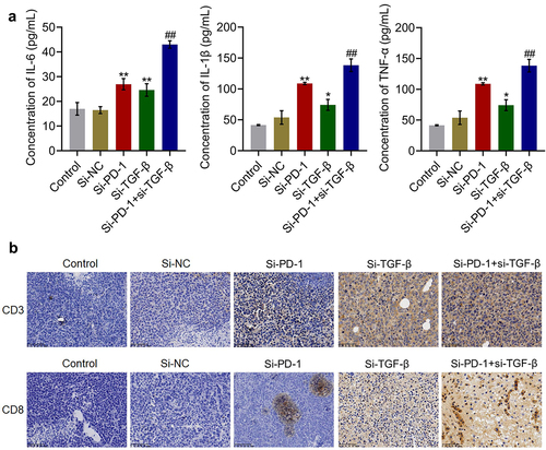 Figure 7. Si-PD-1 combined with si-TGF-β synergistically enhanced the percentage and cytotoxicity of CD8+ T cells in tumor tissues. H22 cells treated with blank medium, si-NC, si-PD-1, si-TGF-β, and si-PD-1 + si-TGF-β were transplanted into mice to establish the xenograft animal model; when the tumor size reached 100 mm3, RFA was performed. A. The production of IL-6, IL-1β, and TNF-α in tumor tissues was measured by ELISA. B. The percentage of CD3+CD8+ T cells in tumor tissues was determined by flow cytometry (*p < 0.05 vs. si-NC, **p < 0.01 vs. si-NC, ##p < 0.01 vs. si-PD-1).