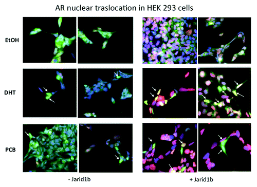 Figure 4. Immunofluorescence analysis of AR nuclear translocation in HEK293 cells transiently cotransfected with the plasmid 3.1-hJarid1b-myc-his following DHT or PCB treatment. Primary antibodies against AR and pcDNA 3.1-hJarid1b-myc-his were used to detect them. Secondary conjugated antibodies were used to detect AR (green channel) or Jarid1b (red channel). Images were obtained at either 20× or 32× magnification.