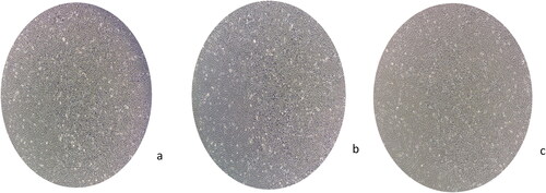 Figure 1. Fibroblast like morphology of MSCs derived from (a) wharton’s jelly, (b) amniotic membrane, (c) adipose tissue, cells at passage-3 with 90% confluency (Inverted microscope, 100x magnification).