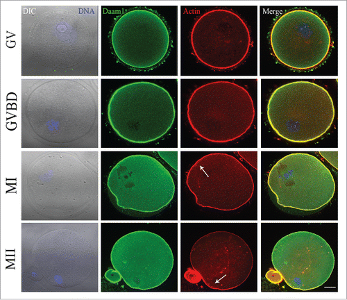 Figure 1. Localization of Daam1 during mouse oocyte meiotic maturation. Confocal imaging analysis of Daam1 and actin localization during mouse oocyte meiotic maturation based on staining with an anti-Daam1 antibody. Daam1 co-localized with actin at the cortex of oocyte from the GV stage to the MII stage. Arrow indicates the location of actin cap. Blue: chromatin; Green: Daam1; Red: actin. Bar = 20 μm.