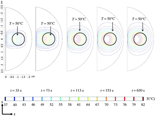 Figure 8. Coronal views of the temperature contour evolutions for different time instants, assuming that the local blood perfusion rate is temperature-dependent.