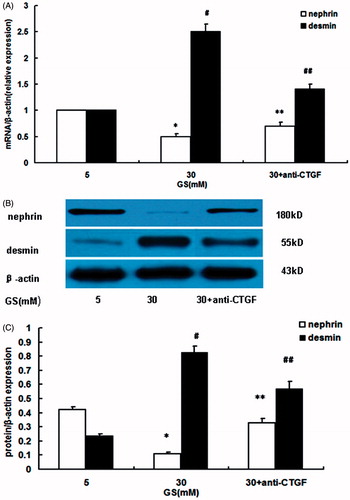 Figure 3. Effects of CTGF inhibition by anti-CTGF antibody on high glucose-induced EMT in podocytes. (A) Nephrin and desmin mRNA expression. (B and C) Nephrin and desmin protein expression. Compared with normal glucose conditions, high glucose downregulated nephrin mRNA and protein expression, but upregulated desmin mRNA and protein expression. Treatment with anti-CTGF antibody reversed EMT, showing by preventing nephrin downregulation and desmin overexpression (GS, glucose; Man, mannitol; mM:mmol/L,*p < 0.05 vs. 5 mM GS, #p < 0.05 vs. 5 mM GS, **p < 0.05 vs. 30 mM GS, ##p < 0.05 vs. 30 mM GS, n = 3).