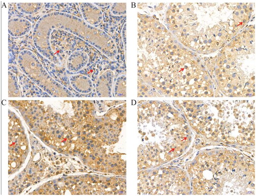 Figure 4. Immunohistochemical staining of LYZL6 protein at different developmental stages of yak testes (400×); (A) 6 months of Ashidan yak; (B) 18 months of Ashidan yak; (C) 30 months of Ashidan yak; (D) 72 months of Ashidan yak.