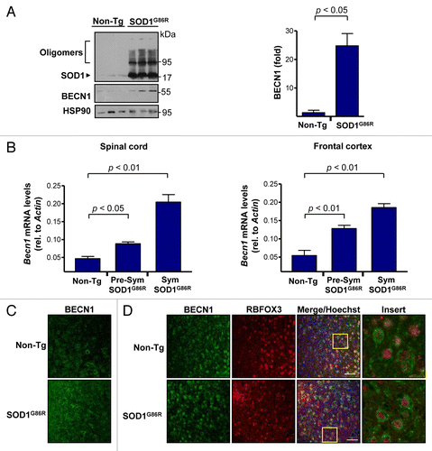 Figure 1. Increased levels of BECN1 in the spinal cord and frontal cortex of transgenic SOD1G86R mice. (A) SOD1 oligomers, BECN1, and HSP90 expression were determined in spinal cord protein extracts from symptomatic SOD1G86R transgenic (end point of disease) or non-transgenic litter mate control mice (Non-Tg) by western blot. Each lane represents an independent mouse. HSP90 was monitored as a loading control. Right panel: quantification of BECN1 expression levels in spinal cord of transgenic SOD1G86R mice and non-transgenic age-matched controls. Mean and standard error are shown for 3 independent animals per group. (B) In parallel, Becn1 mRNA levels were measured by real-time PCR in the SOD1G86R transgenic mice at the presymptomatic stage (Presym; 90 d after birth) or end point of disease (Sym) in spinal cord (left panel) and in frontal cortex (right panel). Mean and standard error are shown for the analysis of 3 animals per group. (C) Immunofluorescence assay of BECN1 and RBFOX3 staining were performed in frontal cortex tissue derived from SOD1G86R and non-transgenic litter-mate control mice (Non-Tg). A merged image of the triple staining is presented. (D) Using samples described in (C), the expression of BECN1 and the neuronal marker RBFOX3 were analyzed by indirect immunofluorescence followed by confocal microscopy analysis. The right panel shows a magnification of the area marked with a yellow square. A representative image is presented of the analysis of at least 3 independent animals for genotype. Scale bars: 50 μm.