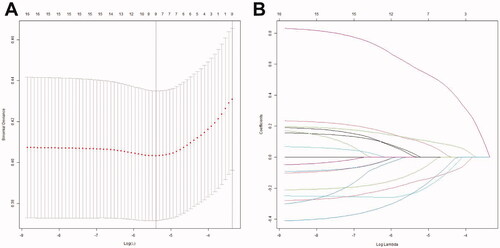 Figure 1. Selection of predictors using the LASSO logistic regression model (coronary artery lesions were evaluated using the internal lumen diameter). (A) Optimal parameter (lambda) selection in the LASSO model used fivefold cross-validation via minimum criteria. The partial likelihood deviance (binomial deviance) curve was plotted versus log(lambda). Dotted vertical lines were drawn at the optimal values by using the minimum criteria and the 1 SE of the minimum criteria (the 1-SE criteria). (B) LASSO coefficient profiles of the 16 features. A coefficient profile plot was produced against the log(lambda) sequence. The optimal lambda resulted in nine features with non-zero coefficients. LASSO: least absolute shrinkage and selection operator; SE: standard error.