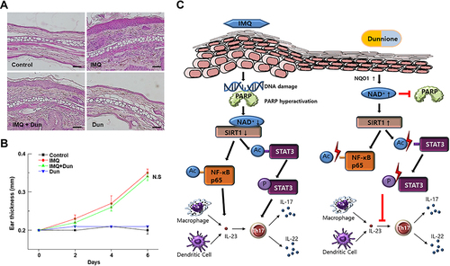 Figure 8 Effect of Dun on IMQ-induced ear-thickening in SIRT1−/− mice. (A) Phenotypical presentation and corresponding histological analyses (H&E staining) of mouse ear skin. (B) Thickness of right ear skin measured on the indicated days (means ± S.D., n = 5). (C) Model of the effect of Dun on IMQ-induced psoriasis-like dermatitis.