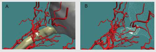 Figure 8. Three-D reconstruction of orbital arterial system, enlarged. The central retinal artery (arrowheads) can be seen piercing the optic nerve (A), and running within the optic nerve (B)