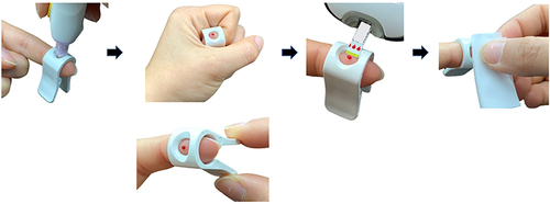 Figure 4 SMBG assistive device supplied as an accessory. This is the SMBG assistive device that, after a number of prototypes, is currently being provided to patients who wish to have it as an accessory to SMBG (Roche DC Japan K.K., Minatoku, Tokyo, Japan).