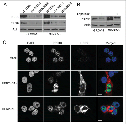 Figure 2. HER2 signaling regulates PRP4K expression. (A) IGROV-1 and SK-BR-3 cell lines were transduced with control or a HER2 targeting shRNA lentiviral vector and cultured for 48 h. Total cell lysates were prepared and subjected to Western blot analysis for HER2 and PRP4K expression. (B) IGROV-1 and SK-BR-3 cell lines were treated with 7.5 μM 0.1 μM lapatinib (respectively) for 48 h to inhibit HER2 signaling. Total cell lysates were subjected to Western blot analysis for PRP4K expression. (C) MCF-7 cells were transfected with constitutively active (CA) or kinase dead (KD) HER2 and analyzed by immunofluorescence confocal microscopy using an anti-HER2 (Red) and anti-PRP4K (Green) antibody. Nuclei were stained with DAPI. Scale bars = 10 microns.