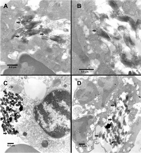 Figure S2 Transmission electron microscopic images of fetal blood mononuclear cells incubated with 500 μg/mL SBA15-cal for 2 hours. (A) Many SBA15-cal were seen within a vacuole in the cytosol of a macrophage without any obvious damage to any organelle (thick arrows). (B) Many SBA15-cal particles were seen within the cytosol of a macrophage and some of them were seen adherent to mitochondria without any obvious damage (thick arrow). (C) Many SBA15-cal were in the cytosol of a macrophage (thick arrow), in contact with a lysosome (thin arrow) without any evidence of phagosome-lysosome fusion. (D) Many SBA15-cal particles were within a vacuole in the cytosol of a neutrophil polymorph without any obvious damage to the organelles (thick arrows).