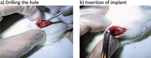 Figure 2. The operation. Drilling of the hole between the femoral condyles into the bone marrow cavity (a) and insertion of the implant (b). See text for details.