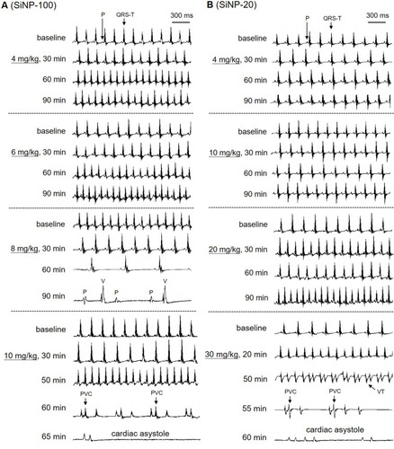 Figure 8 Typical ECGs showing the arrhythmogenic effects of SiNP-100 (A) and SiNP-20 (B) in adult mice in vivo. Both SiNP-100 and SiNP-20 induced sinus tachycardia, ventricular tachyarrhythmias (PVC or VT), complete atrio-ventricular conduction block (AVB), cardiac asystole and sudden cardiac death in a dose- and time-dependent manner. Note that the dose of SiNP-100 (6 mg/kg) was much lower than the dose of SiNP-20 (30 mg/kg) beginning to induce cardiac asystole, suggesting that SiNP-100 was more toxic than SiNP-20.
