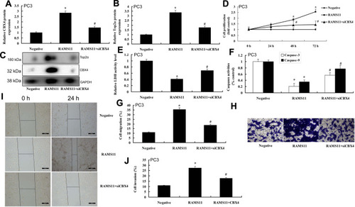 Figure 7 The inhibition of CBX4 reduced the pro-cancer effects of lncRNA RAMS11 in prostate cancer cells. CBX4 and Top2α protein expressions (A–C), cell proliferation (D), LDH activity cytotoxicity (E), caspase-3/9 activity levels (F), migration rate (G, H), invasion rate (I, J) in vitro model of PC3 cell. *p<0.01 compared with negative group, #p<0.01 compared with over-expression of RAMS11 group.