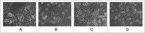 Figure 4. Morphology of MP and GR cells by phase contrast microscopy. MiaPaCa-2 cells were selected for increased levels of gemcitabine resistance. Gemcitabine-resistant (GR) cells were derived using incrementally increased levels of gemcitabine (A) MP; (B) GR300; (C) GR800; (D) GR2000.