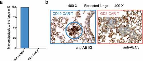 Figure 5. GD2-CAR-T cells prevent metastasis formation in vivo. Lungs of NSG mice injected with 5 × 106 MDA-MB-231 cells into the fourth mammary fat pad on day 0, treated on day +7 with either 5 × 106 CD19-CAR-T or 5 × 106 GD2-CAR-T and sacrificed on day +21 were fixed and stained with the pan-cytokeratin staining AE1/3 to determine metastatic infiltration. In a), the presence of AE1/3 positive cells in the lungs of mice was quantified, 4 mice each group. In b), representative images for both groups are shown, demonstrating the presence and absence of metastatic cells