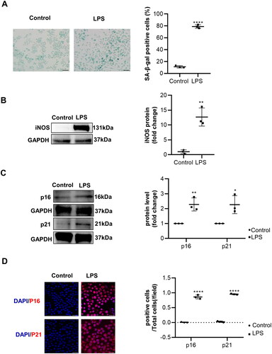 Figure 1. The senescence of macrophages induced by lipopolysaccharide (LPS) cultures of RAW 264.7 macrophages and usage of lipopolysaccharide (LPS, 1 μg/mL) were performed to induce macrophages senescence. (A) The senescence detection of LPS-induced macrophages was achieved by utilizing SA-β-gal staining as well as performing a quantitative analysis of the number of positive cells. n = 3. Scale bar, 50 μm. (B–C) Representative images of WB and statistical data showing the protein levels of iNOS and senescence markers p16 and p21, with or without LPS. n = 3. (D) Representative immunofluorescence staining images of p16, p21, and nuclei in macrophages treated with or without LPS. Scale bar, 20 μm. Data are presented as mean ± SD, two-tailed t-test (A, B, and C), * p < 0.05, ** p < 0.01, *** p < 0.001.