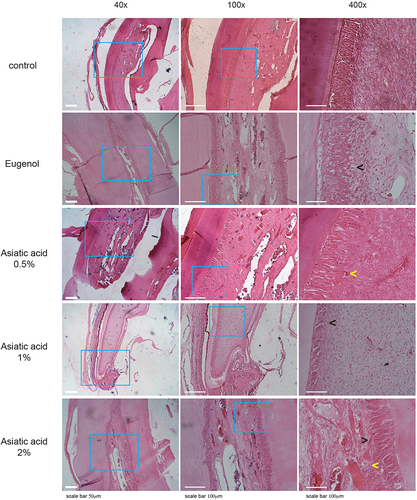 Figure 4 The histopathology of dental pulp to assess the inflammation after treatment with Asiatic acid. The blue box indicated the coronal-pulp chamber and pointed as an area of observation H&E staining. Yellow arrows represent vascular leakage, characterised by erythrocyte discharge from blood vessels, while black arrows represent inflammatory cells. The replication of the group was 3.