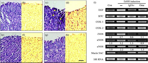 Figure 3. Immunohistochemical and reverse transcription-polymerase chain reaction (RT-PCR) analyses confirming inhibition by Aloe vera gel fraction. After deparaffinization, tissue sections were rehydrized and oxidized in 1% (v/v) periodic acid for 5 min. Then, sections were washed with distilled water (DW) and stained with Schiff′s reagent for 15 min. Thereafter, sections were counter-stained with Mayer′s haematoxylin and rinsed in running tap water. They were finally dehydrated, cleared and mounted. Sections of (a and b) control, (c and d), only alcohol-treated, (e and f) alcohol-treated with gel fraction and (g and h) omeprazole-treated groups were observed using phase contrast microscope (Axovert 200, Carl Zeiss, Weimar, Germany); (i) *Acute gastric lesions. Comparison of mRNA expressions of alcohol-induced acute lesions using RT-PCR. PCR conditions are described in Materials and Methods section. Data show representative classical analysis in triplicate independently.