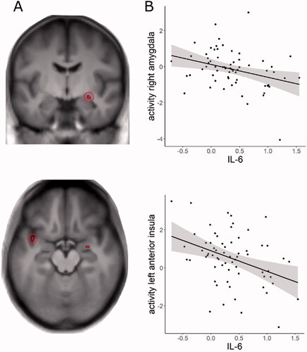 Figure 1. Correlation of log transformed baseline interleukin-6 (IL-6) levels and stress task-related neural activity (A) Cluster of significant correlation between IL-6 and neural activity for the contrast stress > control condition in the right amygdala and left anterior insula (p = 0.05, FWE corrected, clusters are displayed on the average T1 image of the sample). (B) Scatter plot of the correlation between IL-6 and parameter estimates of the activation in the left anterior insula and right amygdala. For visualization purposes, parameter estimates were extracted from a sphere of 6 mm around the peak activation (anterior insula: −40, 4, −16; amygdala: 34, −4, −28).