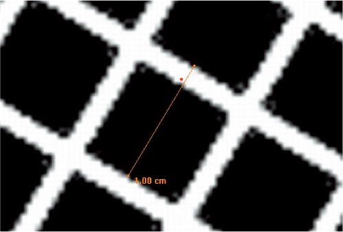 Figure 14. Linear measurement on MR image of MRI phantom performed to verify the geometry on objects on MR images.