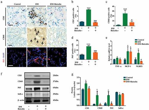 Figure 3. Assessments of inflammation in renal tissues of diabetic mice with baicalin treatment