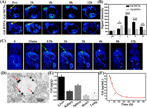 Figure 6 (A) T1 pseudo color images of tumor bearing mice pre- and post-injection of Gd-MCNs or Gd-DTPA at 1 h, 4 h, 8 h, and 12 h (The yellow arrows indicate the tumor); (B) the corresponding signal intensity of tumor; (C) T1 pseudo color images of mice pre- and post-injection of Gd-MCNs at 15 min, 0.5 h, 1 h, 2 h, 4 h, 8 h, and 12 h (The green arrows indicate gallbladder); (D) TEM image of liver (The red arrows indicate the deposited Gd-MCNs); (E) Gd amount deposited in major organs; (F) blood half-life determination of Gd-MCNs. *P < 0.05, **P < 0.01, ***P < 0.001.