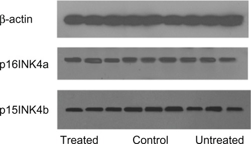 Figure 4 Western blot analysis of p16INK4a and p15INK4b expression in bone marrow cells.