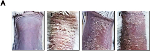 Figure 1 (A) The morphology changes of the lesion skin in psoriasis mice. I, Control; II, Model; III, Cur 50 mg/kg; IV, Cur 100 mg/kg. The selected pictures were typical skin lesions in each group, N=4 per group.