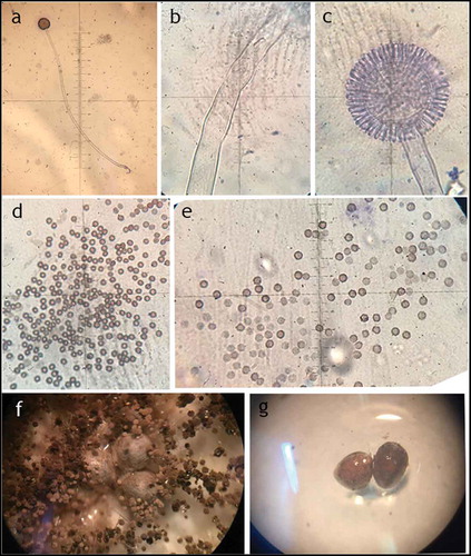 Figure 5. Micro-morphology of Aspergillus sp. LBM 134. (a) Conidiophore, 10X; (b) stipe, 400X; (c) vesicle, 400X; (d) and (e) conidia, 1000X; (f) and (g) sclerotia, 4X