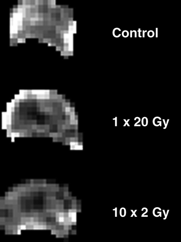 Figure 2.  Representative IAUC maps from differently treated C3H mouse mammary carcinomas. Maps are for either untreated tumours or 48-hours following local irradiation with 1×20 Gy or 10×2 Gy. Each pixel in the figure represents the IAUC measured over the first 90 s post injection of Gd-DTPA.