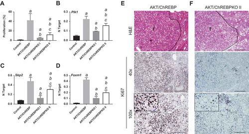 Figure 4. Depletion of ChREBP results in decreased proliferation rate of AKT-overexpressing lesions. AKT/ChREBP mice (n = 15) were sacrificed 29 weeks post injection (w.p.i.). AKT/ChREBPKO mice (n = 15 for each group) were sacrificed at two distinct time points: 29 w.p.i. (indicated as AKT/ChREBPKO I) and 52 w.p.i. (AKT/ChREBPKO II), respectively. (a) Differences in proliferation indices (as assessed by Ki67 index) between controls (injected with empty vector), AKT/ChREBP, AKT/ChREBPKO I, and AKT/ChREBPKO II mice. (b–d). Differences in the mRNA levels of proliferation promoting genes (Plk1, Skp2, and Foxm1; as determined by quantitative real-time RT-PCR) in the same mouse cohorts. Quantitative values for Plk1, Skp2, and Foxm1 mRNA were calculated by using the PE Biosystems Analysis software and expressed as Number target (NT). NT = 2−ΔCt, wherein ΔCt value of each sample was calculated by subtracting the average Ct value of the target gene from the average Ct value of the β-Actin gene (housekeeping gene). Tukey–Kramer test: P < 0.0005 a, vs control (mice injected with empty vector); b, vs AKT/ChREBP; c, vs AKT/ChREBPKO I mice. (e) Large AKT/ChREBP HCC (T) characterized by very high rate of proliferation. (f) Low proliferative activity in an AKT/ChREBPKO II HCC (T). The striking differences in proliferation degree can be better appreciated in insets. HCC are demarcated from the surrounding non-tumorous tissue with dotted lines. Original magnifications: 40x and 100x in the large pictures, 400x in insets. Scale bar: 500µm for 40x, 100µm for 100x. Abbreviations: HE, hematoxylin and eosin staining; T, tumor (HCC).