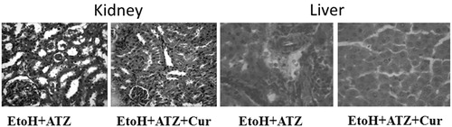 Figure 6. Protective effects of curcumin (Cur) on the histopathological changes in the kidney and liver induced by the combine effects of EtoH (5 mg/kg, 50%v/v) plus ATZ (300 mg/kg b.wt.) in rats. In the kidney, many tubules are degenerate and contain protein casts in the lumina of EtoH + ATZ animals whereas no visible lesions seen in the kidney of EtoH + ATZ co-administered Cur animals. H & E, ×400 Mag. There is a mild to moderate portal congestion and periportal cellular infiltration by mononuclear cells in the EtoH + ATZ animals whereas no visible lesions seen in the liver of EtoH + ATZ animals co-administered Cur animals.