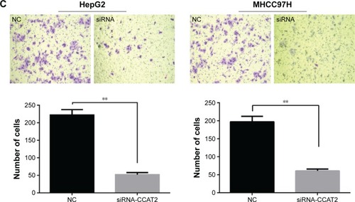 Figure 2 Effect of CCAT2 on HCC cells migration and invasion.