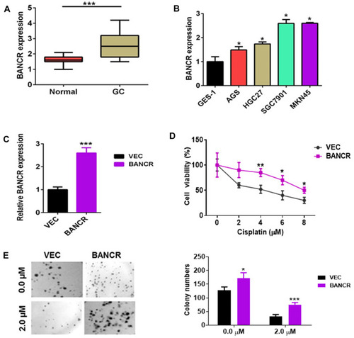 Figure 1 The expression of BANCR in GC tissues and cancer cell growth. (A) The BANCR level was increased in GC tissues (n=35) compared to adjacent normal tissues (n=35). (B) The BANCR level in the human non-malignant gastric epithelial cell line (GES-1) and cancer cell lines (AGS, HGC27, SGC7901 and MKN45) were examined by qPCR. Data are represented as the means ± SD from three independent experiments. (C) The level of BANCR was tested in BANCR-overexpression AGS cells by qPCR analysis. (D) BANCR overexpression increased the cell viability of AGS cells treated with cisplatin. Pictures were taken in light microscope. Magnification is 40X. (E) A clonogenic survival assay was performed using BANCR-overexpression AGS cells treated with cisplatin. Data are represented as the means ± SD from three independent experiments. *P<0.05, **P<0.01, and ***P<0.001 were considered as significant difference.