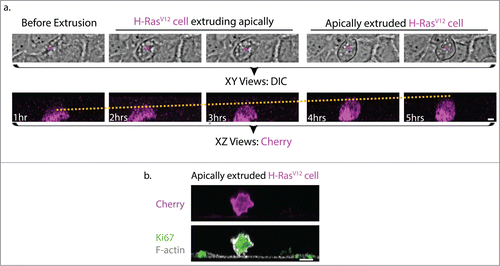 Figure 1. Morphological comparisons between H-RasV12 expressing cell undergoing extrusion and H-RasV12 expressing cell that has been extruded. (a) Still images of brightfield (top panel, magenta asterisk indicates H-RasV12 expressing cell) and confocal fluorescence XZ cross-sections (bottom panel) from live imaging of single H-RasV12 expressing Caco-2 cells within a wild-type epithelia monolayer. The yellow dotted line in the fluorescence XZ cross-sections indicates the gradual increase in the height of the single H-RasV12 expressing cell as extrusion takes place. Based on the relative height of the extruding cell to its neighboring cell, the process of extrusion can be classified into 3 stages: Before extrusion, H-RasV12 cell extruding apically and apically extruded H-RasV12 expressing cell. (b) Immunofluorescence XZ cross-section of an apically extruded H-RasV12 expressing cell that is loosely attached on the untransfected epithelia monolayer and stained for the proliferation marker Ki67. Scale Bar: 5 μm.