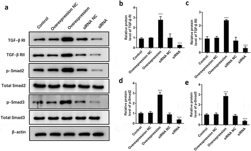Figure 7. ATF3 promotes the activation of TGF-β/Smad signaling pathway in keloid fibroblast cells