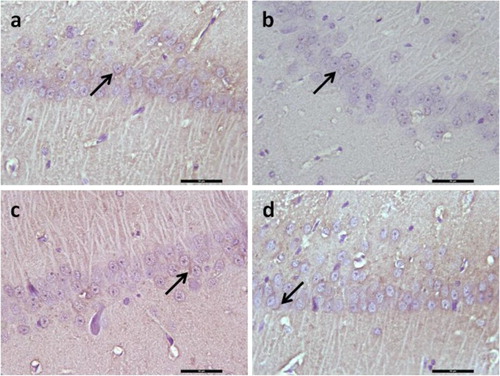 Figure 5. Representative image illustrating BDNF expression (arrows) in hippocampal formation. Control (a), Diabetes (b), Diabetes + YC-1 (c) and Diabetes + Zaprinast group in CA1 region. BDNF expression was decreased in diabetes in CA1 region of the hippocampus, whereas in diabetes + YC-1 and diabetes + zaprinast rats BDNF was similar to those in the control group in the CA1 regions. Scale bars: 50 μm.