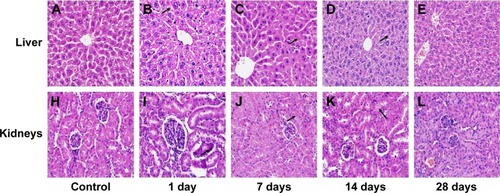 Figure 2 Photomicrographs.Notes: Hepatic (A–E) and renal (H–L) tissues of the CdTe quantum dot-treated (experimental) group and physiologic saline-treated (control) group mice for periods of up to 28 days. (A) Control group hepatocytes exhibiting normal central veins, liver cell cords, and hepatic sinusoids; (B) 1-day group hepatocytes exhibiting mild hydropic degeneration (black arrow); (C) 7-day group hepatocytes exhibiting diffuse edema and eosinophilic changes (black arrow); (D) 14-day group hepatocytes exhibiting severe diffuse hydropic degeneration accompanied by ballooning degeneration (black arrow); (E) 28-day group hepatocytes exhibiting binucleate regenerating liver cells, minimal sinusoidal dilation, and reduced inflammatory cell infiltration around the central veins; (H) control group renal cells exhibiting clear glomerular and renal tubular structures; (I) 1-day group renal cells exhibiting slight edema (black arrow); (J) 7-day group renal cells exhibiting renal tubular edema (black arrow); (K) 14-day group renal cells exhibiting severe tubular and severe cloudy swelling, leading to cellular rupture and dissolution (black arrow) of the renal tubules; (L) 28-day group renal cells exhibiting regeneration and a moderately restored state with slight infiltration of interstitial inflammatory cells. Hematoxylin and eosin, 400×.