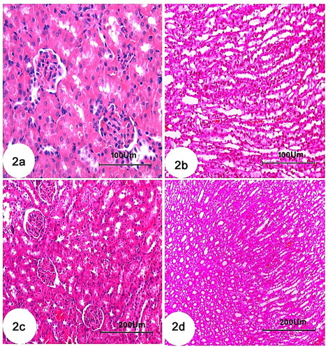 Figure 2. Photomicrographs of kidney section of treated groups (a,b): CCl4 + rats BM-MSCs and (c,d): CCl4 + mice BM-MSCs showing improvement of histological structure of glomeruli and renal tubules. (H&E stain; Scale bar of a and b = 100 µm, Scale bar of c and d = 200 µm).