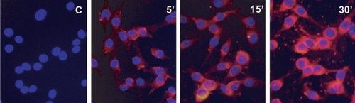 Figure 4 Cellular uptake of the ITNPs by M21 cells in vitro. The ITNPs were added to the chamber yielding a final concentration of 12 μmol/ml. After 5, 15, and 30 minutes of incubation, the cells were washed, stained with DAPI and observed by fluorescence microscopy.