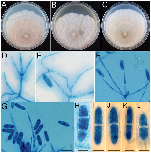 Figure 4. Hypomyces orthosporus (HMAS 279649). (A−C) Cultures after 7 d at 25 °C (A: on CMD, B: on MEA, C: on PDA); (D) Conidiophores and phialides; (E−G) Phialides and conidia; (H−L) onidia. Scale bar: D−G = 10 μm; H−L = 5 μm.