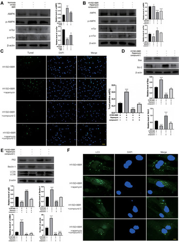 Figure 4 Under HY/SD conditions, BBR regulate autophagy and apoptosis of ADSCs through the AMPK/mTor pathway. (A) The expression of p-APMK and p-mTor under HY/SD conditions. β-actin served as a control. (B) The expression of p-APMK and p-mTor in ADSCs incubated with the rapamycin and compound C. β-actin served as a control. (C) Tunel assay in different treatment ADSCs groups (Scale Bar = 25 μm). (D and E) The expression of apoptosis and autophagy-related proteins in ADSCs for different processing groups. β-actin served as a control. (F) LC3 immunofluorescence in different treatment ADSCs groups. (Scale Bar = 5 μm). Data were mean ± SEM (n = 3). (*P < 0.05; **P < 0.01; ***P < 0.001 vs HY/SD+BBR group).
